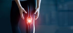 Osteoarthritis Studies