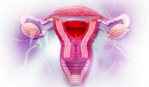 Uterine Fibroid Header